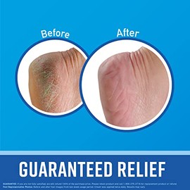 O'Keeffe's for Healthy Feet Foot Cream - 3 oz Tube (1 Pack) - Guaranteed Relief for Extremely Cracked, Dry Feet, Repairing Skincare, Instantly Boosts and Retains Moisture Levels | O'Keeffe's