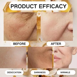 Bee Venom Skin Restoration Cream, Bee Venom Comprehensive Cream-50g, Firming Moisturizing For All Skin Typess