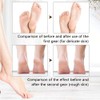 Electric Callus Remover Electric Foot Care Pedicure Set LED Rechargeable
