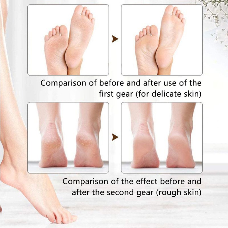 Electric Callus Remover Electric Foot Care Pedicure Set LED Rechargeable