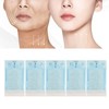 Face Lifting, Collagen Silk Threads, Collagen Silk Threads for Lifting,