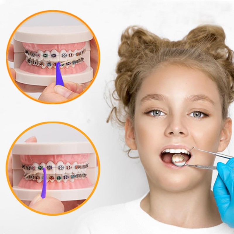INGJIA Orthodontic Braces with 5 Placements, 500 Pieces Orthodontic Elastic