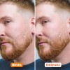 Kit Barba Serum Natural + Rodillo Micro Agujas Crecimiento