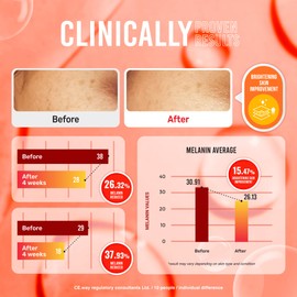 Koji White Pure Kojic Acid Soap | Glycerin Soap Bar for Gentle Skin Brightening and Exfoliation with Tea Tree, Coconut Oil, Hyaluronic Acid & Vitamin C, Vegan, 2.82 oz