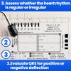 BEIQIYA 3pcs ECG 7 Step Ruler, Transparent EKG Calipers Ruler,