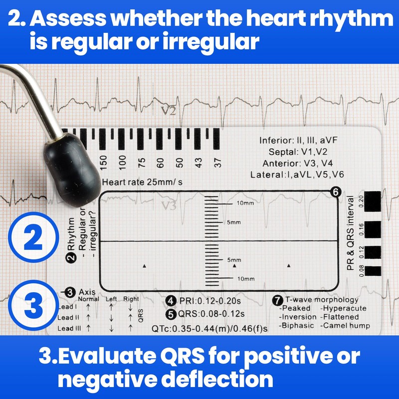 BEIQIYA 3pcs ECG 7 Step Ruler, Transparent EKG Calipers Ruler,