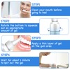 Bettinay 2 Pcs Gum Repair Gel, 30 Ml Gum Shield