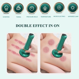 Topblux Electric Cupping Cellulite Massager with Board, Cordless 12 Suction Levels Full Body Relax on Legs Arms Belly Back, One-Touch Pressure Release (Green)