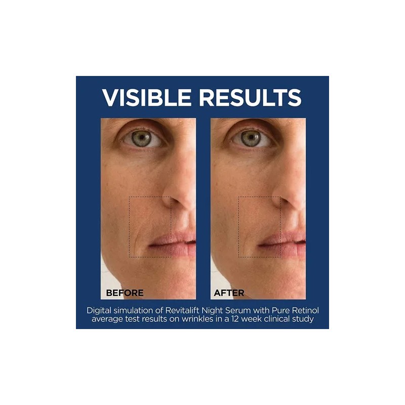 L'oreal Paris Revitalift Suero Nocturno De Retinol 0.3 % reduce