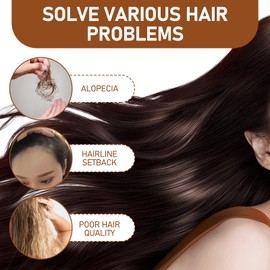 Shampoo Against Hair Loss, Hair Loss Shampoo, Anti Hair Loss Shampoo, Anti Hair Loss, Ginger Shampoo, Practical Volume Shampoo, Suitable for All Hair Types (300 ml)