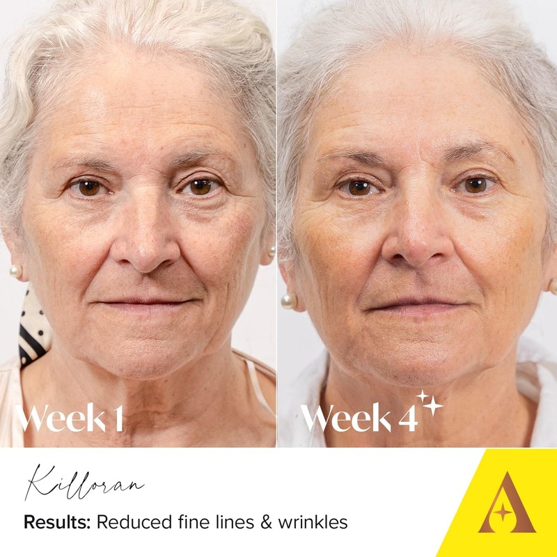 Absolute Collagen Deep Lift Day Cream SPF30 - Hydrating Face