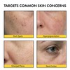 Pores Dark Spot Cream with Arbutin, Tranexamic Acid & Niacinamide