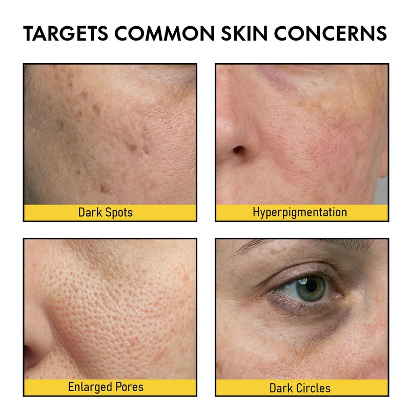 Pores Dark Spot Cream with Arbutin, Tranexamic Acid & Niacinamide