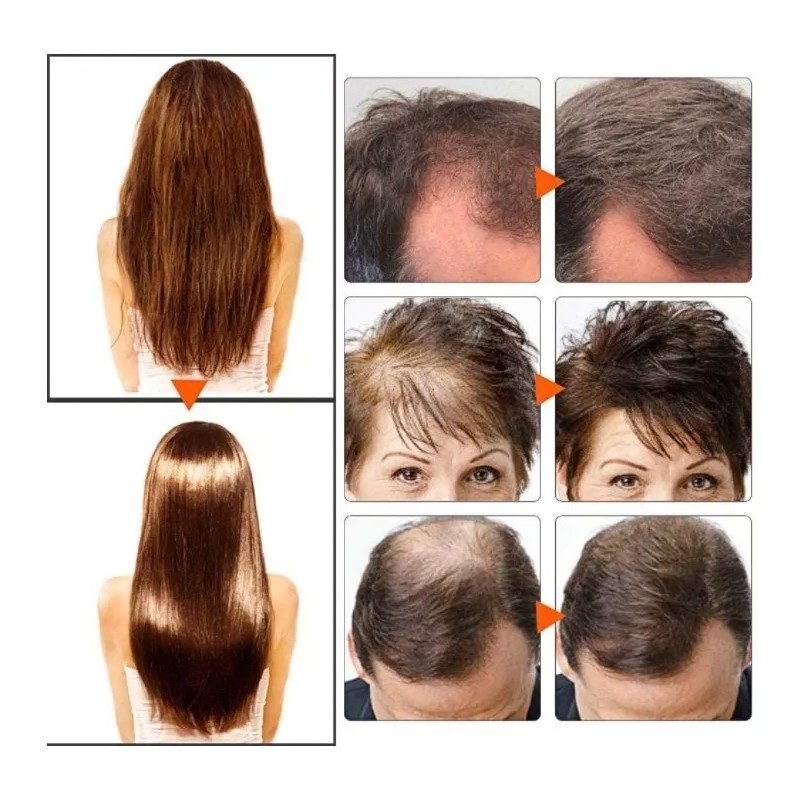 Racotex Locion Para Crecimiento De Pelo Y Barba 100% Efectivo