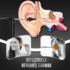 Ear Wax Removal, Electric Ear Irrigation Flushing System with 3 Adjustble Modes, Safe and Effective Ear Cleaning Tool, Electric Ear Cleaning Kit Waterproof USB Rechargeable for Adults