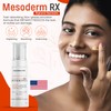Mesoderm RX Anti Sun Spots, 50ml