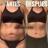 Parches Abdomen Adelgazar Reductivo Pzas Neutra