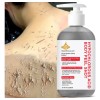 Gel Corporal Exfoliante Ácido Hipocloroso 200ml No