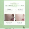 Tónico Facial Centella Asiática Bioaqua Antiacne