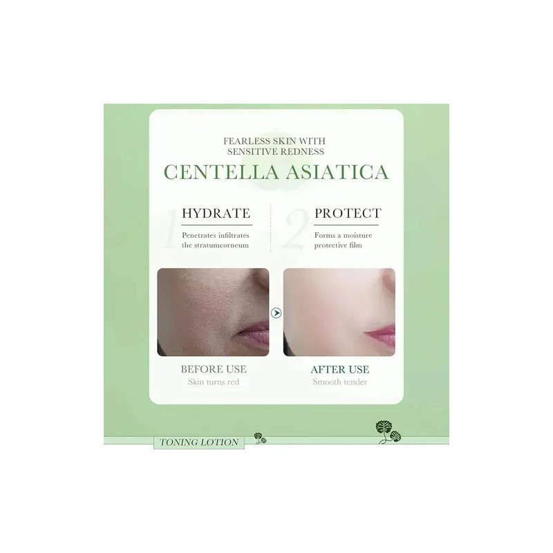 Tónico Facial Centella Asiática Bioaqua Antiacne