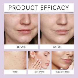 Anti-imperfecciones Y Aclarante Piel Acneica Crema Azelaic