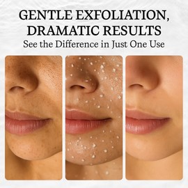 Vivo Per Lei Facial Peeling Gel - Contains Dead Sea Minerals and Nut Shell Powder - Gentle Face Exfoliator Scrub and Blackhead Remover - Peel Your Skin to a Fresher You - 4.05 Fl oz.