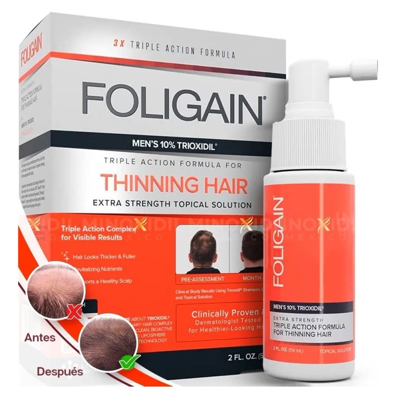 FOLIGAIN Triple Action Complete Formula For Thinning Hair For Men