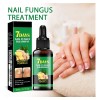 Lápiz Líquido Reparador De Uñas, Tratamiento Para Hongos En
