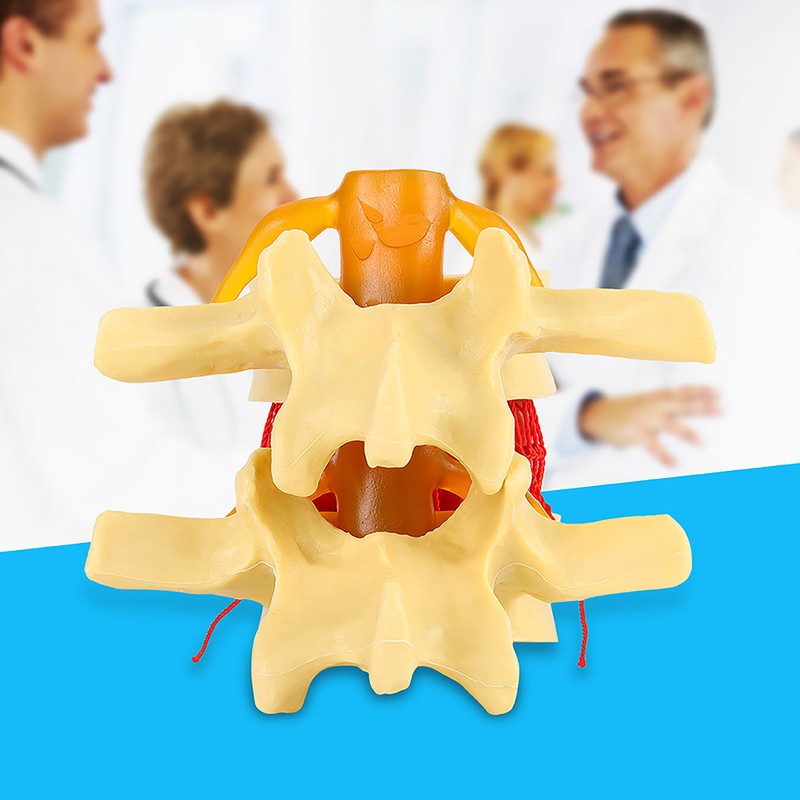 1:1.5 Anatomical Medical Human Spine Lumbar Disc Herniation Demonstration Model
