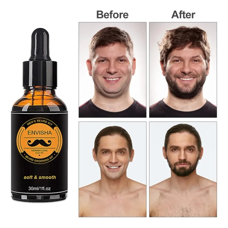 Kit Para Hacer Crecer La Barba, Aceite Esencial Para Barba,