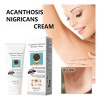 Crema Para La Acantosis Nigricans: Mejora La Pigmentación Y