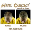 Hair Quicky® Premium Hair Fibres, Pouring Hair, Scattered Hair, Instant