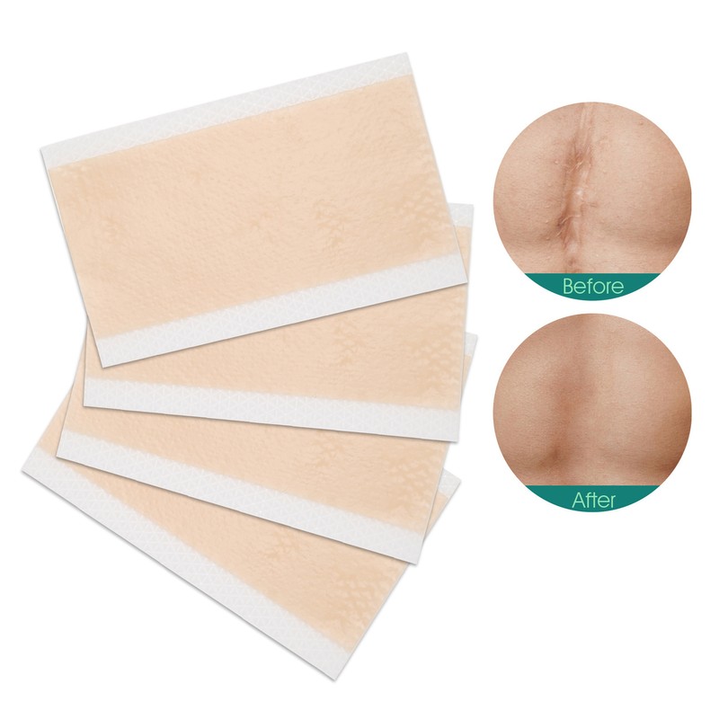 4 Pcs Elaimei Silicone Scar Sheets Stretch Marks Remover Post