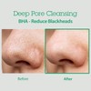Blithe [Blithe]Anti-Polluaging Pore Cleansing Foam BHA 0.5 150ml