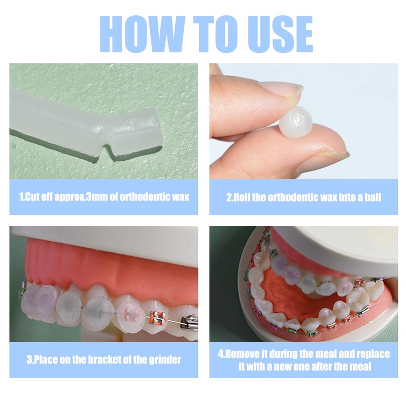 Box of 10 Braces Wax, Orthodontic Wax, for Braces Wearers