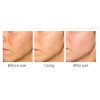 Matrixyl 3000 Peptide Face Cream with Hyaluronic Acid, Retinol, Collagen