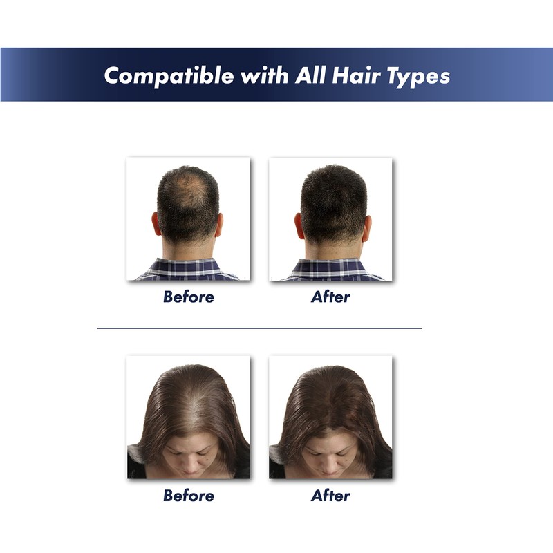 KeraFiber Professional Dark Brown Hair Fibres - Natural Keratin for