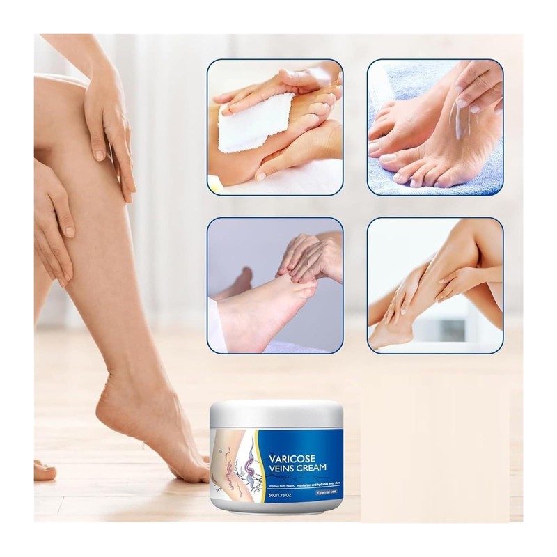 Lmuwecno Varicose Veins Cream(1PCS)