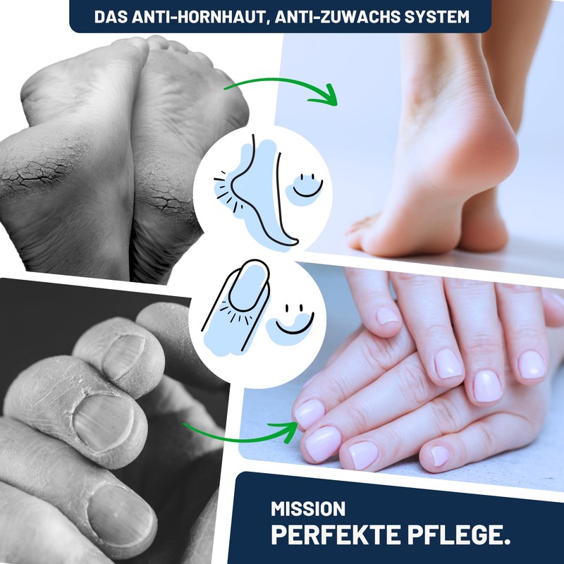 Mr. Fuss® No. 4 - Callus Remover Hand and Foot