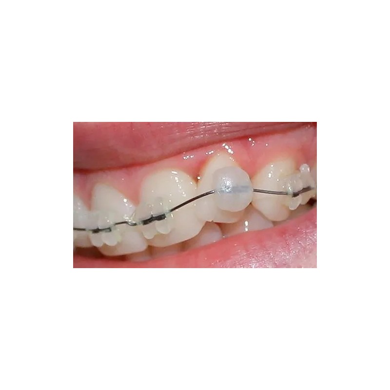 10 Ceras Para Brackets Ortodoncia Dental Borgatta