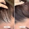 HAIR BURST Hair Growth Biotin Gummies - Daily Vitamins -