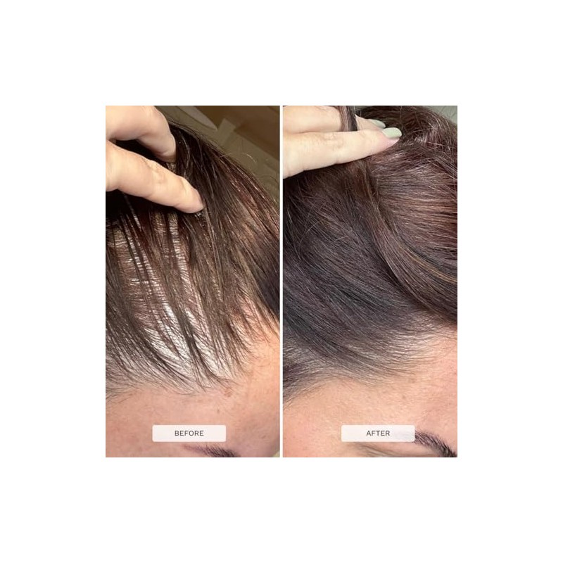 HAIR BURST Hair Growth Biotin Gummies - Daily Vitamins -