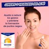 Crema Clearasil Tratameinto Manchas Acne Peroxido Benzoilo Todo Tipo De