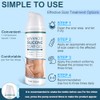 Mitgary Crema Avanzada Para Cicatrices, Gel De Silicona Para Cicatrices,