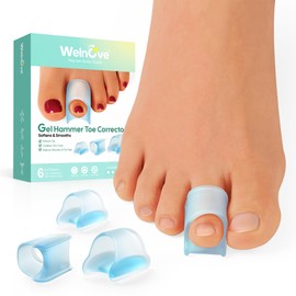 Welnove Hammer Toe Corrector: Toe Straightener - Bunion Corrector & Broken Toe, 3 Different Size for Women and Men, 6PCS, Blue