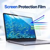 Laptop Screen Protector Film – PET Anti Blue Light Display