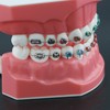 Dentalmall Typodonts Orthodontics Demonstration Model with Metal Wires and Bracket