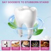 Pack of 28 Teeth Whitening Strips, Teeth Whitening Strips, 14