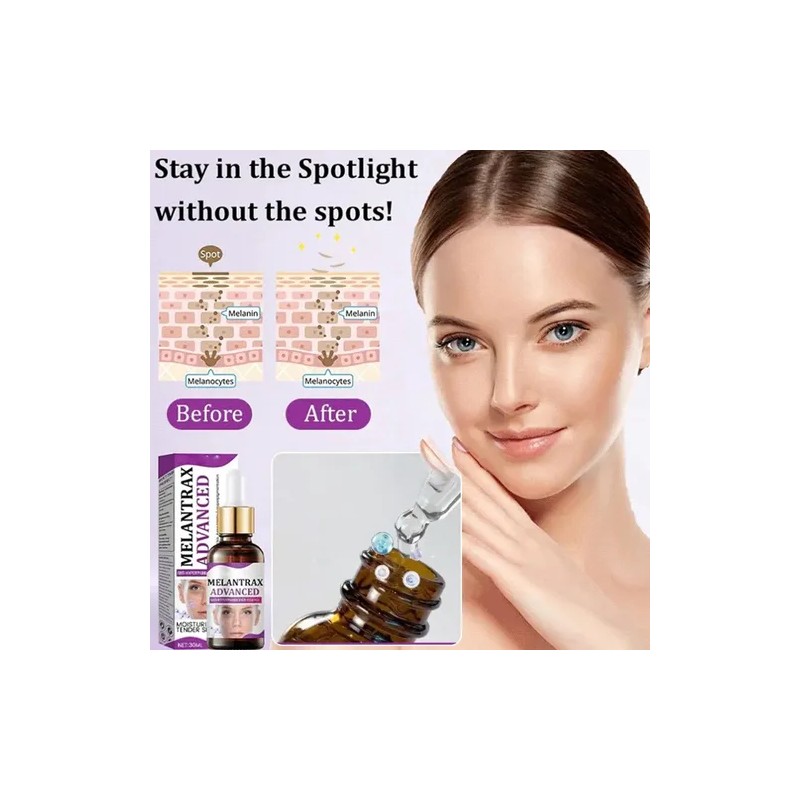 Highly Effective Anti-pigmentation Serum Whitening Blemish R