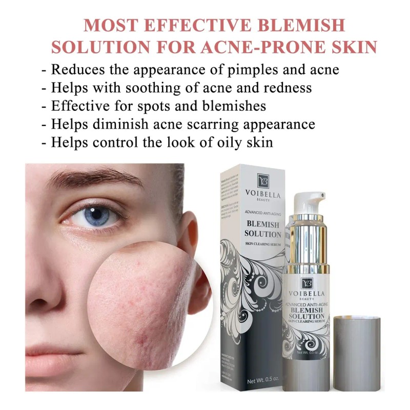 Blemish Spot Treatment Cream - Gentle Serum For Pimples,